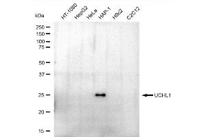 Western blotting analysis using UCHL1 antibody (ABIN7800707).