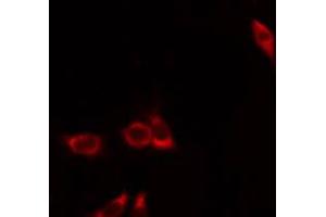 ABIN6274392 staining Hela by IF/ICC. (FASTKD1 Antikörper  (Internal Region))