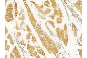 ABIN6258751 and ABIN6274763 at 1/100 staining human tongue carcinoma by IHC-P. (AZI1 Antikörper  (C-Term))
