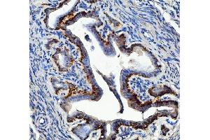 IHC analysis of EEF2 using anti-EEF2 antibody (ABIN7599561).
