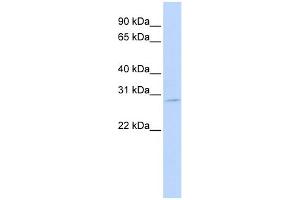 WB Suggested Anti-EXOSC7 Antibody Titration:  0. (EXOSC7 Antikörper  (N-Term))