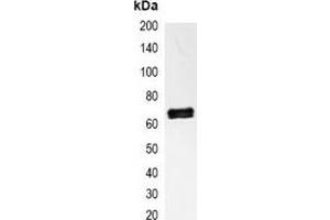 Immunoprecipitation of NF-kappaB p65 from 0.