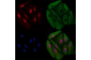 ABIN6258847 and ABIN6275709 staining  cells by IF/ICC. (RAD23B Antikörper  (N-Term))