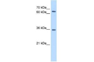 WB Suggested Anti-PPP2R3B Antibody Titration:  0. (PPP2R3B Antikörper  (C-Term))