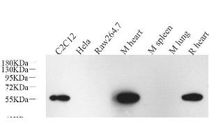 Western Blot analysis of various samples using Desmin Monoclonal Antibody at dilution of 1:1000.