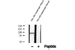 Western blot analysis of extracts of hela cells treated with TPA/UV, using Phospho-RSK2 (Ser227) Antibody .