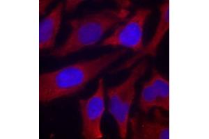 Immunofluorescence staining of methanol-fixed HeLa cells using Phospho-SYN1-S9 antibody (ABIN2987713). (SYN1 Antikörper  (pSer9))