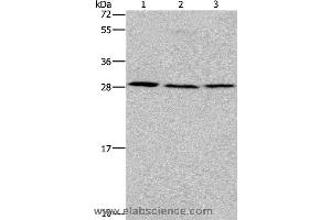 Western blot analysis of Human fetal liver tissue, 293T and 231 cell, using TP53INP1 Polyclonal Antibody at dilution of 1:200 (TP53INP1 Antikörper)