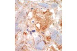 Image no. 2 for anti-Mast/stem Cell Growth Factor Receptor (KIT) (N-Term) antibody (ABIN359890) (KIT Antikörper  (N-Term))