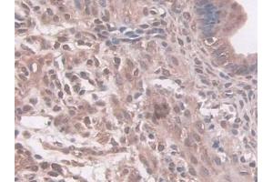 DAB staining on IHC-P; Samples: Mouse Uterus Tissue (NAT1 Antikörper  (AA 9-254))