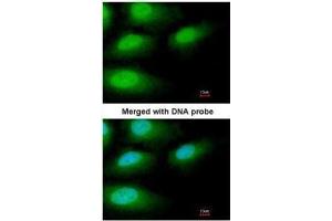 ICC/IF Image Immunofluorescence analysis of paraformaldehyde-fixed HeLa, using IRAK3, antibody at 1:200 dilution. (IRAK3 Antikörper)