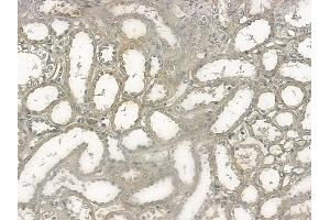 ABIN6255311 and ABIN6267132 at 1/100 staining human normal kidney tissue by IHC-P. (KSR1 Antikörper  (pSer392))