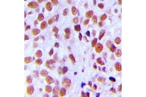 Immunohistochemistry (IHC) image for anti-X-Ray Repair Complementing Defective Repair in Chinese Hamster Cells 5 (Double-Strand-Break Rejoining) (XRCC5) (C-Term), (pThr714) antibody (ABIN7302726)
