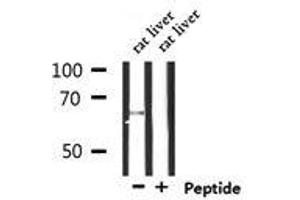 Western blot analysis of extracts from rat liver, using SLC6A20 Antibody.