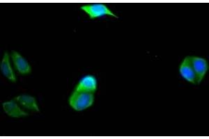 Immunofluorescence staining of Hela Cells with ABIN7127762 at 1:50, counter-stained with DAPI. (Rekombinanter PIK3CA Antikörper  (Catalytic Subunit alpha))