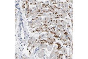 Immunohistochemical staining (Formalin-fixed paraffin-embedded sections) of human heart muscle with PKP2 polyclonal antibody  shows strong cytoplasmic positivity in myocytes. (Plakophilin 2 Antikörper  (AA 72-194))