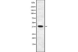 Western blot analysis SSTR5 using LOVO whole cell lysates (SSTR5 Antikörper  (Internal Region))