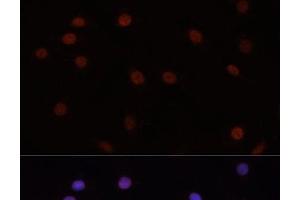 Immunofluorescence analysis of C6 cells using DNMT3B Polyclonal Antibody at dilution of 1:100. (DNMT3B Antikörper)