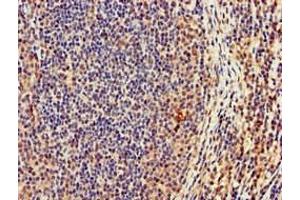 Immunohistochemistry of paraffin-embedded human lymph node tissue using ABIN7165180 at dilution of 1:100 (CASC1 Antikörper  (AA 1-300))