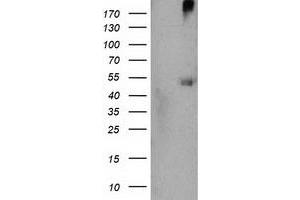 Western Blotting (WB) image for anti-Sedoheptulokinase (SHPK) antibody (ABIN1500922) (SHPK Antikörper)