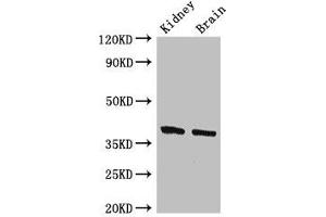 Western Blot Positive WB detected in: Mouse kidney tissue, Mouse brain tissue All lanes: FOXE1 antibody at 2.