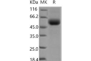 Western Blotting (WB) image for Transforming Growth Factor, beta Receptor II (70/80kDa) (TGFBR2) protein (Fc Tag) (ABIN7321210) (TGFBR2 Protein (Fc Tag))