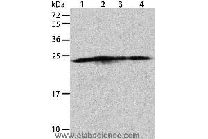 Western blot analysis of Hela, A431, 293T and Jurkat cell, using BAK1 Polyclonal Antibody at dilution of 1:900 (BAK1 Antikörper)