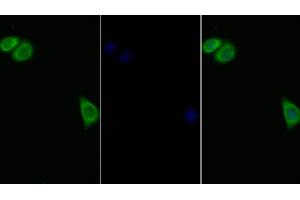 Detection of IL11Ra in Human Hela cell using Polyclonal Antibody to Interleukin 11 Receptor Alpha (IL11Ra) (IL11RA Antikörper  (AA 194-329))