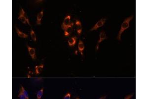 Immunofluorescence analysis of HeLa cells using PDE3A Polyclonal Antibody at dilution of 1:100 (40x lens). (PDE3A Antikörper)
