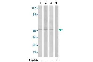 Western blot analysis of extracts from HT-29 cells (Lane 1 and 4), LoVo cells (Lane 2) and A-549 cells (Lane 3), using S1PR1 polyclonal antibody . (S1PR1 Antikörper)