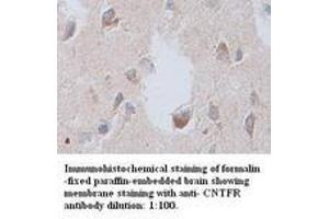 Image no. 1 for anti-Ciliary Neurotrophic Factor Receptor (CNTFR) antibody (ABIN791093) (CNTF Receptor alpha Antikörper)