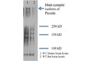 Western Blot analysis of Rat and mouse brain lysates showing detection of Piccolo protein using Mouse Anti-Piccolo Monoclonal Antibody, Clone 6H9-B6 (ABIN863104 and ABIN863105). (Piccolo Antikörper)
