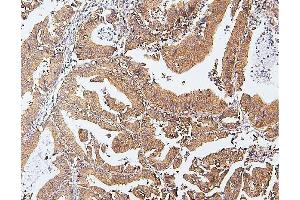 IHC analysis of CDK5 using anti-CDK5 antibody (ABIN6719393). (CDK5 Antikörper  (AA 1-226))