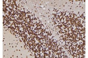 ABIN6257255 and ABIN6274428 at 1/100 staining Rat brain tissue by IHC-P.