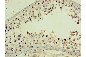 Immunohistochemistry of paraffin-embedded human testis tissue using ABIN7162631 at dilution of 1:100 (PNMA5 Antikörper  (AA 4-442))