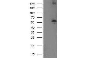 Western Blotting (WB) image for anti-Protein Phosphatase, Mg2+/Mn2+ Dependent, 1B (PPM1B) antibody (ABIN1500375) (PPM1B Antikörper)