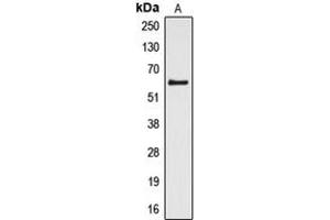 Western blot analysis of Cytochrome P450 4Z1/2 expression in HL60 (A) whole cell lysates. (Cytochrome P450 4Z1/2 (Center) Antikörper)