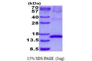 Image no. 1 for Uroplakin 2 (UPK2) protein (His tag) (ABIN1098745)