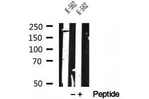 Western blot analysis of extracts of K-562 cells, using RB1CC1 antibody. (FIP200 Antikörper)