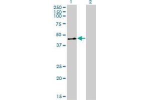 Western Blotting (WB) image for anti-Zinc Finger Protein 24 (ZNF24) (AA 1-369) antibody (ABIN599467) (ZNF24 Antikörper  (AA 1-369))
