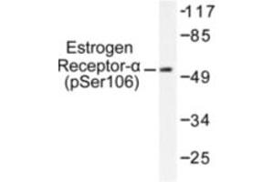 Image no. 1 for anti-Estrogen Receptor 1 (ESR1) (pSer106) antibody (ABIN318017) (Estrogen Receptor alpha Antikörper  (pSer106))