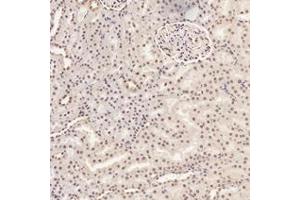 Immunohistochemistry (Paraffin-embedded Sections) (IHC (p)) image for anti-Required For Meiotic Nuclear Division 5 Homolog A (RMND5A) antibody (ABIN7075401)