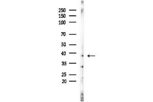 anti-3-hydroxyisobutyryl-CoA Hydrolase (HIBCH) (Internal Region) antibody