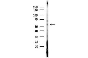 anti-6-phosphofructo-2-Kinase/fructose-2,6-Biphosphatase 3 (PFKFB3) (pSer461) antibody