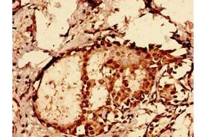 Immunocytochemistry (ICC) image for anti-GLE1 RNA Export Mediator (GLE1) (AA 141-380) antibody (ABIN7162002)