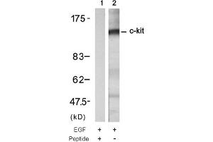 Image no. 1 for anti-Mast/stem Cell Growth Factor Receptor (KIT) (Tyr721) antibody (ABIN319334) (KIT Antikörper  (Tyr721))