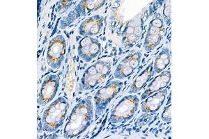 Immunohistochemistry analysis of paraffin embedded rat colon using CYPIW1 (ABIN7073674) at dilution of 1: 500 (CYP2W1 Antikörper)
