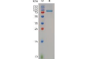 SDS-PAGE (SDS) image for Matrix Metallopeptidase 13 (Collagenase 3) (MMP13) (AA 20-471) protein (Fc Tag) (ABIN7490699)