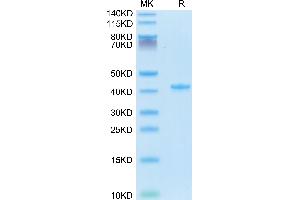 CCL5 Protein (AA 24-91) (Fc Tag)