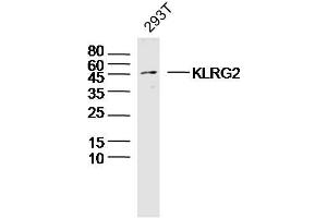 293T lysates probed with KLRG2 Polyclonal Antibody, Unconjugated  at 1:300 dilution and 4˚C overnight incubation. (KLRG2 Antikörper  (AA 101-200))